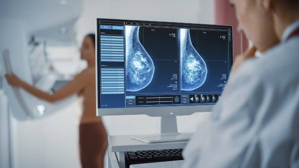 Médico evaluando una mamografía