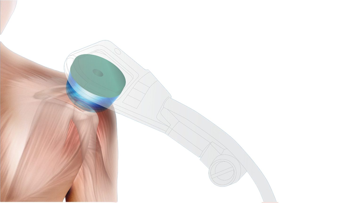 Innovation in rehabilitation and pain management 4