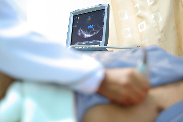 Echocardiogram performed by a doctor