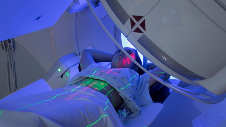Radioterapia: Tratando El Cáncer