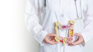 colon cancer