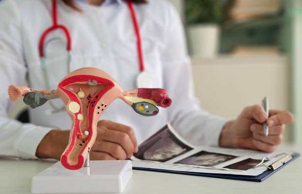 El dolor que no se debe normalizar: una mirada ginecológica a la endometriosis y el valor del abordaje integral