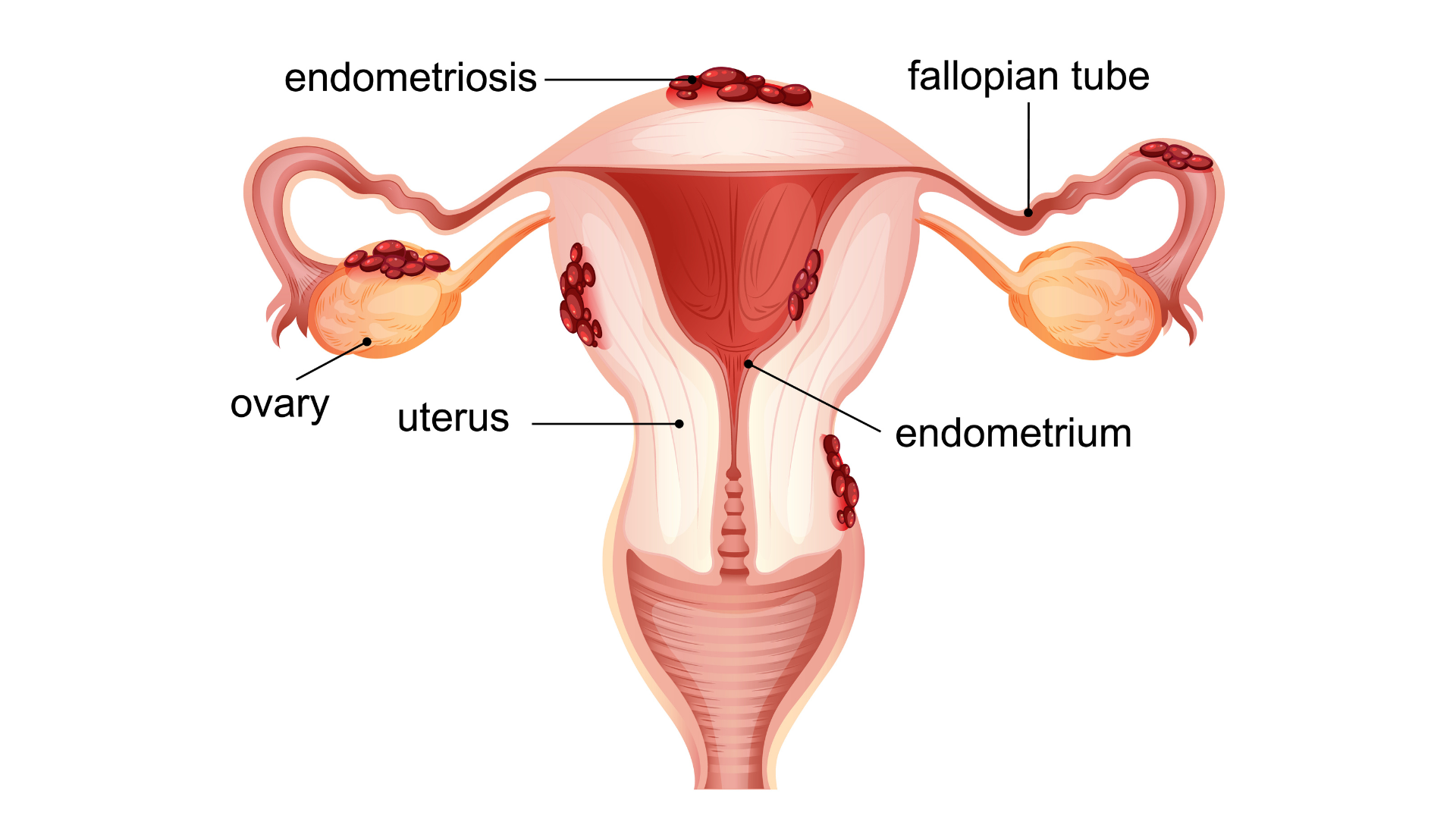Consulta médica ginecológica